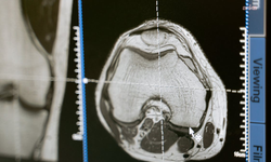 İngiltere Ulusal Sağlık Servisi Yöneticisi: Savaşa bağlı tedarik sorunundan endişeliyiz, bazı ürünler günler içinde tükenebilir